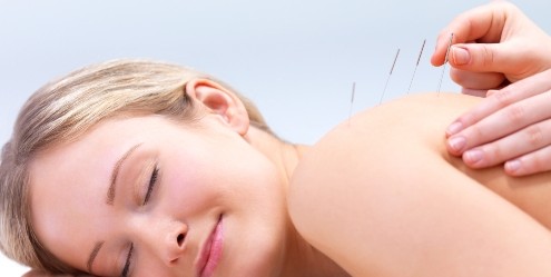 acupuncture for allergy
