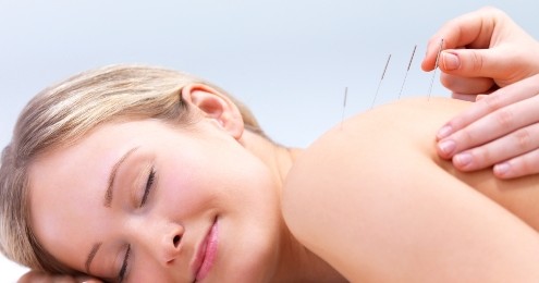 acupuncture for allergy